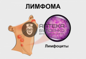 Статья «Причины развития лимфомы и как распознать заболевание»